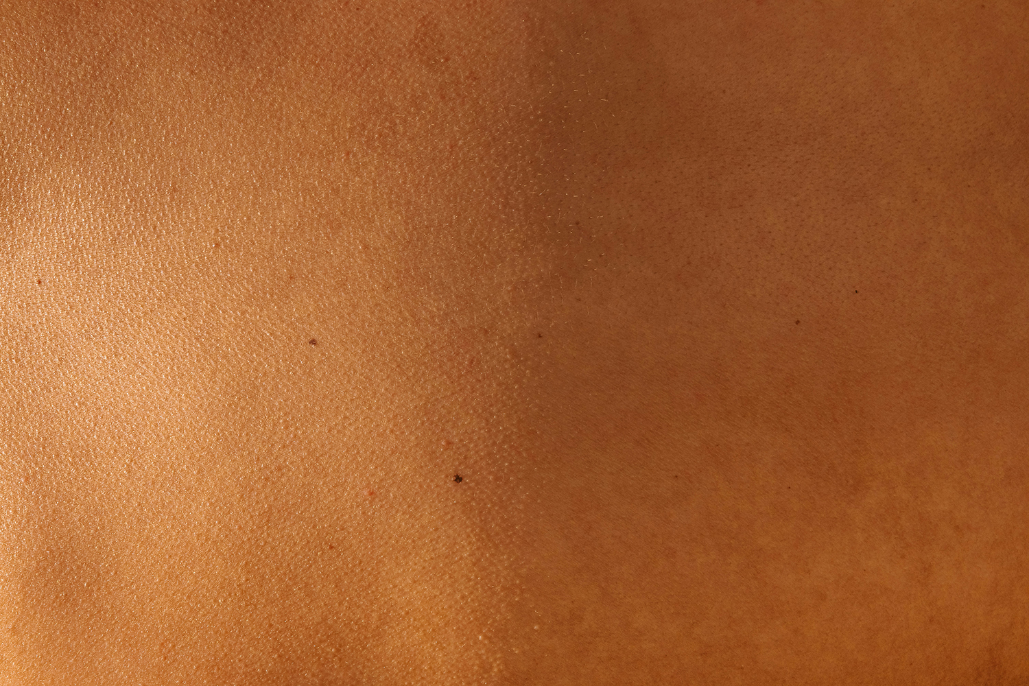 close up of skin
