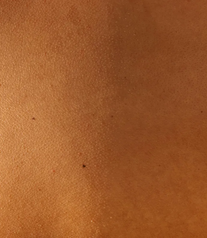 close up of skin