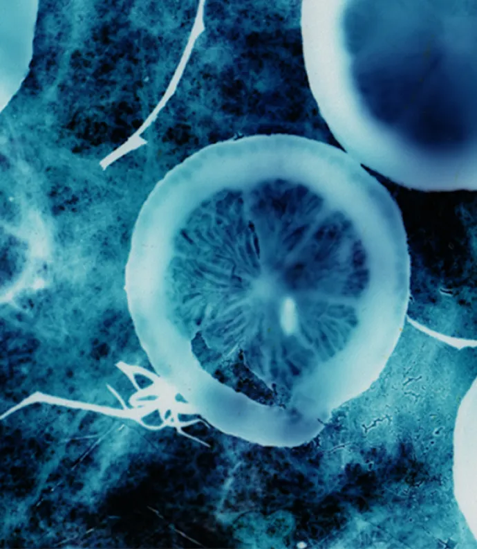 a cluster of jellyfish
