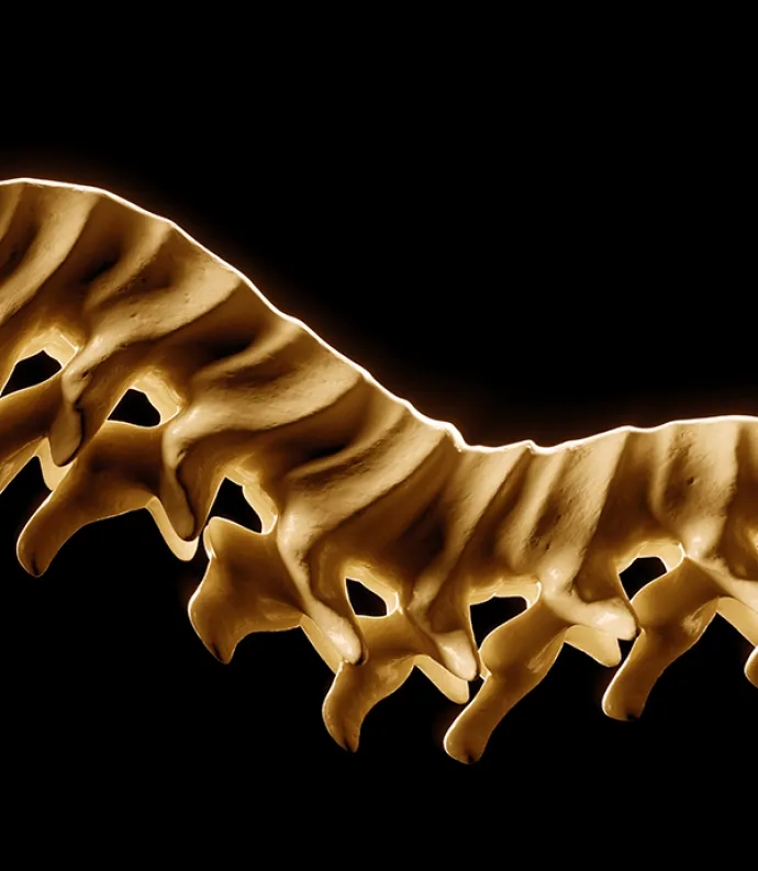 Bent Spine